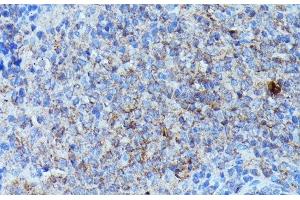 Immunohistochemistry of paraffin-embedded Rat spleen using CSF3 Polyclonal Antibody at dilution of 1:100 (40x lens). (G-CSF 抗体)