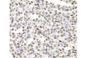 Immunohistochemistry of paraffin-embedded Rat kidney using SOX5 Polyclonal Antibody at dilution of 1:100 (40x lens). (SOX5 抗体)