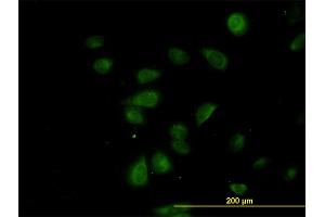 Immunofluorescence of monoclonal antibody to CDK5RAP3 on HeLa cell. (CDK5RAP3 抗体  (AA 1-506))