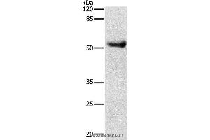 Western blot analysis of Human liver cancer tissue, using DRD4 Polyclonal Antibody at dilution of 1:600 (DRD4 抗体)
