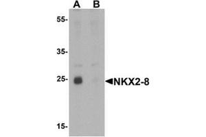 Western blot analysis of NKX2-8 in rat liver tissue lysate with NKX2-8 antibody at 1 ug/mL in (A) the absence and (B) the presence of blocking peptide (NKX2-8 抗体  (Middle Region))