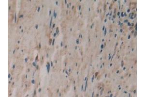 Immunohistochemistry (IHC) image for anti-Phospholipase A2, Group IVA (Cytosolic, Calcium-Dependent) (PLA2G4A) (AA 563-749) antibody (ABIN7438268)