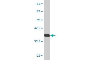 Western Blot detection against Immunogen (37. (ZNF133 抗体  (AA 121-230))