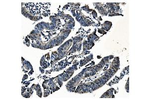 IHC analysis of PCBP1 using anti-PCBP1 antibody (ABIN7600127).