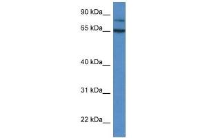 Western Blot showing IRAK2 antibody used at a concentration of 1 ug/ml against Fetal Liver Lysate