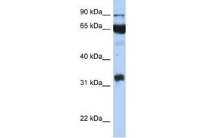 PTGS1 antibody used at 1 ug/ml to detect target protein. (PTGS1 抗体  (Middle Region))