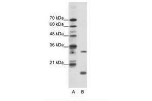 Image no. 1 for anti-MYC Associated Factor X (MAX) (C-Term) antibody (ABIN203016) (MAX 抗体  (C-Term))