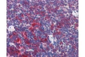 IHC Image for AP22588PU-N Mouse Spleen (formalin-fixed, paraffin-embedded) stained with M6PRBP1followed by biotinylated anti-goat IgG secondary antibody LS-D3, alkaline phosphatase-streptavidin and chromogen. (PLIN3 抗体  (Internal Region))