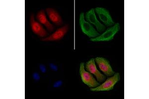 ABIN6255391 and ABIN6267252 staining Hela cells(4h of LPS treatment) by IF/ICC. (CHEK2 抗体  (pSer516))