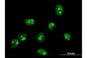 Immunofluorescence of monoclonal antibody to FBL on HeLa cell. (Fibrillarin 抗体  (AA 1-321))