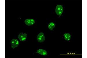 Immunofluorescence of monoclonal antibody to FBL on HeLa cell.