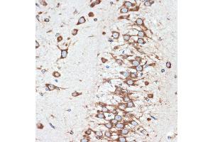 Immunohistochemistry of paraffin-embedded rat brain using LM Rabbit mAb (ABIN7268205) at dilution of 1:100 (40x lens). (LMAN1 抗体)