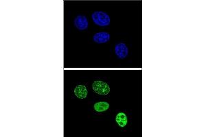Confocal immunofluorescent analysis of PCNA Antibody (C-term) (ABIN389344 and ABIN2839453) with Hela cell followed by Alexa Fluor 488-conjugated goat anti-rabbit lgG (green). (PCNA 抗体  (C-Term))