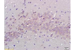 Formalin-fixed and paraffin embedded rat brain labeled with Anti PABP Polyclonal Antibody, Unconjugated (ABIN704786) at 1:200 followed by conjugation to the secondary antibody and DAB staining (PABP 抗体  (AA 101-200))