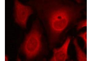 Immunofluorescence staining of methanol-fixed Hela cells using eIF2a(phospho-Ser49) Antibody. (EIF2S1 抗体  (pSer49))