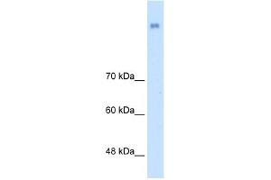 WB Suggested Anti-NRCAM Antibody Titration:  2. (NrCAM 抗体  (N-Term))