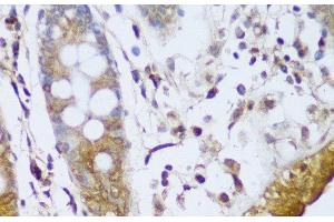 Immunohistochemistry of paraffin-embedded Human colon using GCC2 Polyclonal Antibody at dilution of 1:150 (40x lens). (GCC2 抗体)