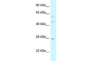 LSM14A antibody used at 1 ug/ml to detect target protein. (LSM14A 抗体)