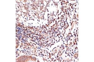 Immunohistochemistry (IHC) image for anti-Arachidonate 5-Lipoxygenase (ALOX5) antibody (ABIN3016895)