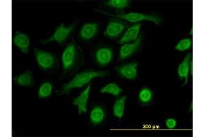 Immunofluorescence of monoclonal antibody to TIMP2 on HeLa cell. (TIMP2 抗体  (AA 27-220))