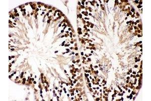 IHC-P: PBK antibody testing of mouse testis tissue (PBK 抗体  (AA 71-322))