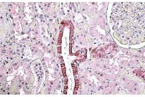 Immunohistochemistry (IHC) image for anti-Transforming Growth Factor, beta-Induced, 68kDa (TGFBI) (Internal Region) antibody (ABIN571098)
