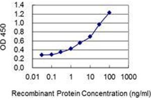 Detection limit for recombinant GST tagged LSM3 is 0. (LSM3 抗体  (AA 1-102))