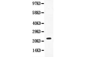 Anti-IL-18 Picoband antibody, All lanes: Anti-IL18  at 0. (IL-18 抗体  (AA 37-193))