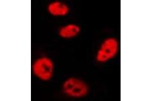 ABIN6275797 staining Hela by IF/ICC. (CHFR 抗体)