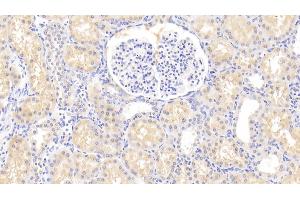 Detection of HLA-DRA in Human Kidney Tissue using Polyclonal Antibody to HLA Class II Histocompatibility Antigen, DR Alpha Chain (HLA-DRA) (HLA-DRA 抗体  (AA 27-216))