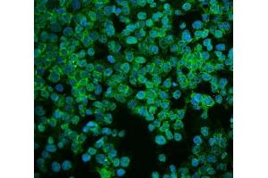 IF analysis of ASS1 using anti-ASS1 antibody (ABIN7601190). (ASS1 抗体  (AA 3-365))