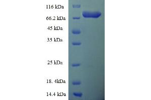 SDS-PAGE (SDS) image for Epoxide Hydrolase 2, Cytoplasmic (EPHX2) (AA 1-555), (full length) protein (His-SUMO Tag) (ABIN5709475) (EPHX2 Protein (AA 1-555, full length) (His-SUMO Tag))