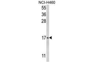 Western blot analysis of LTC4S Antibody (LTC4S 抗体  (N-Term))