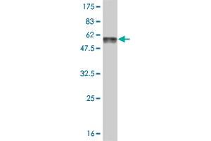 Western Blot detection against Immunogen (57. (AKTIP 抗体  (AA 1-292))