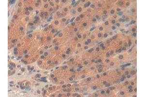 Immunohistochemistry (IHC) image for anti-Sema Domain, Immunoglobulin Domain (Ig), Short Basic Domain, Secreted, (Semaphorin) 3A (SEMA3A) (AA 31-150) antibody (ABIN7430105)