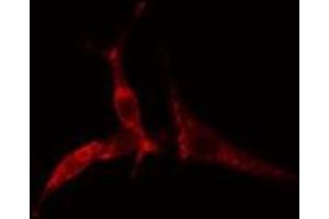 ABIN6275186 staining  COLO205 cells by IF/ICC. (HLA-DOA 抗体)