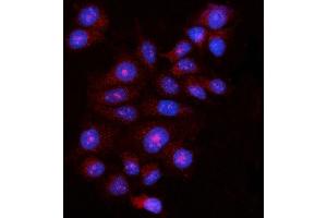IF analysis of FBP1 using anti-FBP1 antibody (ABIN7599395). (FBP1 抗体  (AA 1-44))