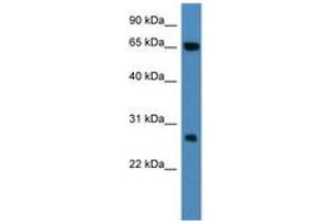 Image no. 1 for anti-Kelch Repeat and BTB (POZ) Domain Containing 8 (KBTBD8) (AA 63-112) antibody (ABIN6746791) (KBTBD8 抗体  (AA 63-112))