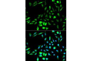 Immunofluorescence analysis of MCF-7 cells using KPNA2 antibody. (KPNA2 抗体  (AA 1-290))