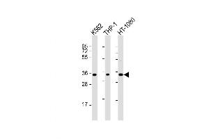 Western Blot at 1:2000 dilution Lane 1: K562 whole cell lysate Lane 2: THP-1 whole cell lysate Lane 3: HT-1080 whole cell lysate Lysates/proteins at 20 ug per lane. (TMEM158 抗体  (AA 186-218))