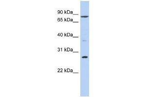 Western Blot showing KLF12 antibody used at a concentration of 1-2 ug/ml to detect its target protein. (KLF12 抗体  (N-Term))