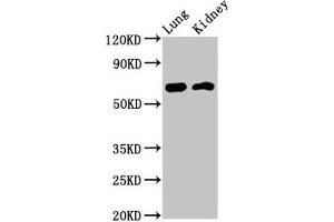 Western Blot Positive WB detected in: Rat lung tissue, Mouse kidney tissue All lanes: IQCB1 antibody at 3. (IQCB1 抗体  (AA 445-598))