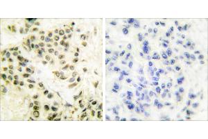 Peptide - +Immunohistochemical analysis of paraffin-embedded human breast carcinoma tissue using DNA-PK antibody. (PRKDC 抗体)