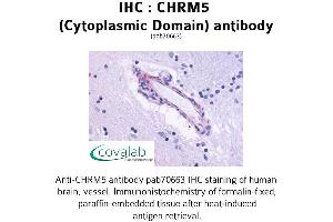 Image no. 1 for anti-Cholinergic Receptor, Muscarinic 5 (CHRM5) (3rd Cytoplasmic Domain) antibody (ABIN1733067)