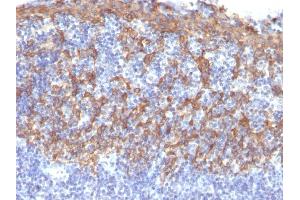 Immunohistochemistry (IHC) image for anti-Keratin 14 (KRT14) (C-Term) antibody (ABIN6939906)