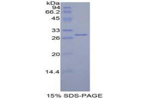 SDS-PAGE analysis of Mouse Mindbomb Homolog 2 Protein. (MIB2 蛋白)