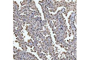 IHC analysis of HOXC4 using anti-HOXC4 antibody (ABIN7603059). (HOXC4 抗体  (Middle Region))