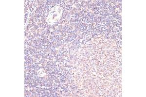 Immunohistochemistry of paraffin-embedded rat spleen using HSF1 antibody (ABIN6131141, ABIN6142021, ABIN6142022 and ABIN6217875) at dilution of 1:100 (40x lens). (HSF1 抗体  (AA 350-529))