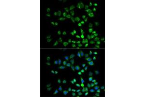 Immunofluorescence (IF) image for anti-Proteasome (Prosome, Macropain) 26S Subunit, Non-ATPase, 10 (PSMD10) (AA 1-226) antibody (ABIN1682352)
