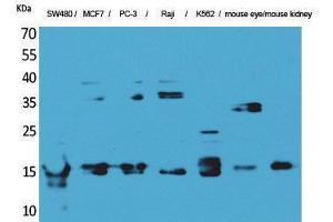 anti-Midkine (Neurite Growth-Promoting Factor 2) (MDK) (Internal Region) antibody
